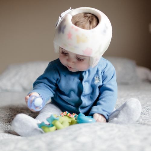 plagiocephaly-flourishing-lives-occupational-therapy-st-claire-shores-mi – 1